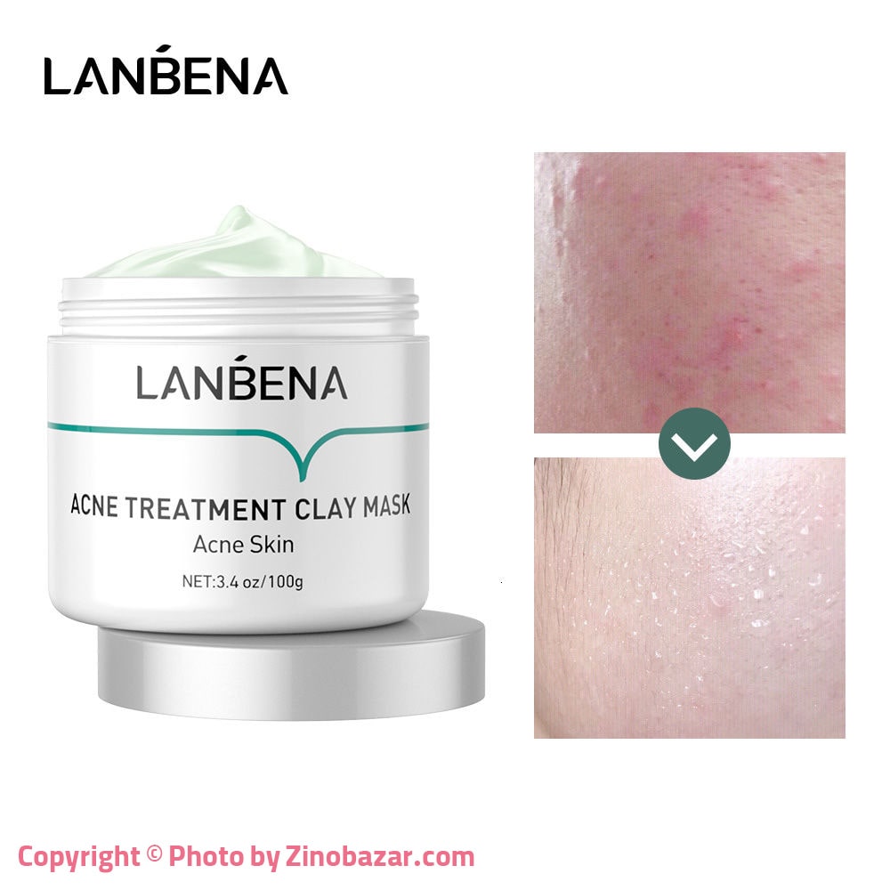 LANBENA Acne Treatment Clay Mask Acne Skin