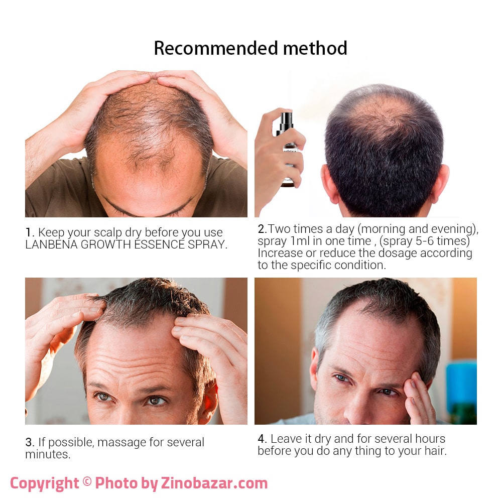 روش استفاده از اسپری گیاهی تقویت و رشد موی سر لانبنا