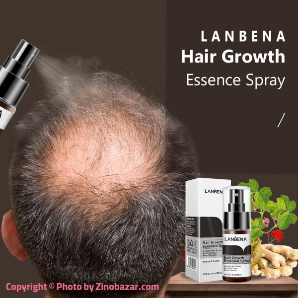 معرفی اسپری گیاهی تقویت و رشد موی سر لانبنا